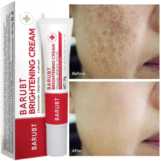 Creme Facial Clareador de Sardas e Melasma - Remoção de Manchas Escuras - 20g