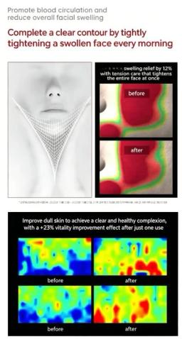 Produtos para Modelagem Facial em V - Image 3