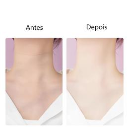 Massageador Aparelho De Beleza Para Pescoço Facial Com Vibração de Ondas Luminosas Anti-Rugas - Image 5