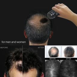 Fibras De Construção De Cabelo Profissional, diluindo Em Pó, Perda De Cabelo Produtos, Rebrota Rápida, Natural Queratina Styling, Preto, Escuro, Marrom - Image 5