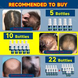 Spray de crescimento capilar para homens e mulheres, cuidados com os cabelos, couro cabeludo Nutre as raízes do cabelo, impede a perda de cabelo, planta natural, crescimento rápido - Image 6