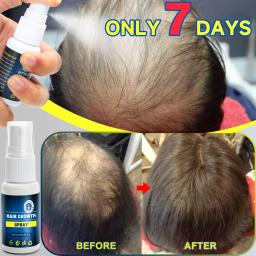 Spray de crescimento capilar para homens e mulheres, cuidados com os cabelos, couro cabeludo Nutre as raízes do cabelo, impede a perda de cabelo, planta natural, crescimento rápido - Image 1