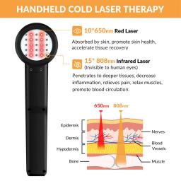 ZJKC-terapia fria do laser para o uso home, fisioterapia para o menisco, categoria médica, infravermelho, dor do corpo, promove a regeneração do tecido, 3W, 5W, 8W, 650nm, x25 - Image 2