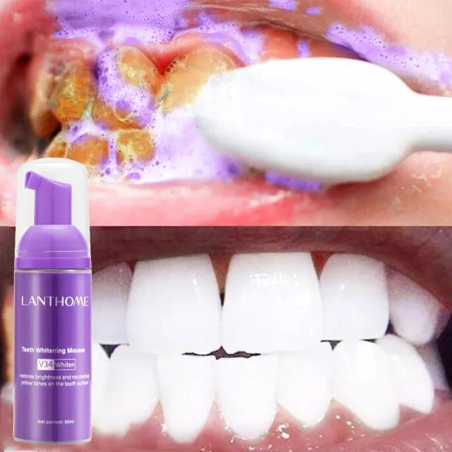Clareamento Dental Eficaz com V34: Enzima em Pasta para Remover Manchas e Placa, Frescor e Higiene Oral Completa.