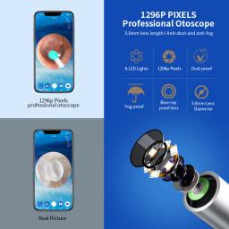 Ne3 limpador de ouvido de alta precisão, ferramenta de remoção de cera de ouvido com câmera, luz led, otoscópio sem fio, kit de limpeza de ouvido inteligente, melhor presente - Image 4