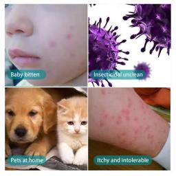 Tratamentos Rápidos para Pulgas e Piolhos Spray, Rápido e Prático, Carrapatos Expelentes para Cães e Gatos, Suprimentos para Saúde Pet, 100ml - Image 3