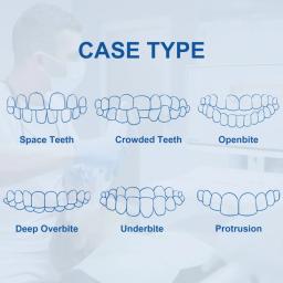 Dental Impression Rubber Material, Silicone Soft Putty, Transparente, Corpo Leve Putty, Material de moldagem - Image 6