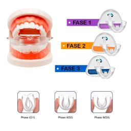 Dispositivo ortodôntico dental transparente, protetor bucal, protetor, dentário, correção de sorriso, macio e duro, 3 estágios - Image 4
