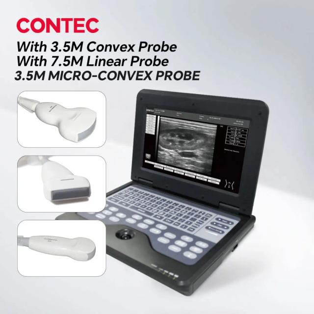 CONTEC Máquina de Ultrassom Digital Portátil com Sonda Convexa/Linear/Cardíaca/Transvaginal