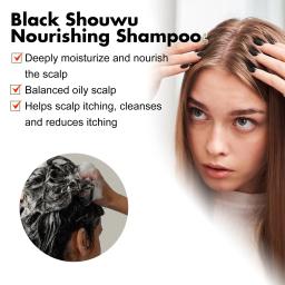 Gengibre Cabelo Crescimento Shampoo, Caspa Tratamento, Anti Itchy, Scalp Oil Control, Cabelo mais grosso Shampoo, Melhorar Thin Hair Caspa - Image 5