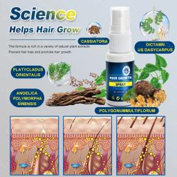 Spray de crescimento capilar para homens e mulheres, cuidados com os cabelos, couro cabeludo Nutre as raízes do cabelo, impede a perda de cabelo, planta natural, crescimento rápido - Image 4