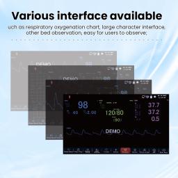 S80A 10,1 '' Multi-parâmetro operado por botão de 3 ou 6 parâmetros Monitor de paciente ICU monitoramento de sinais vitais - Image 5