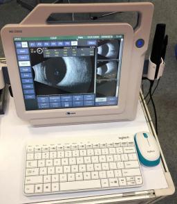 Portátil ultra-sônico A e B Scanner para Oftalmologia - Image 2