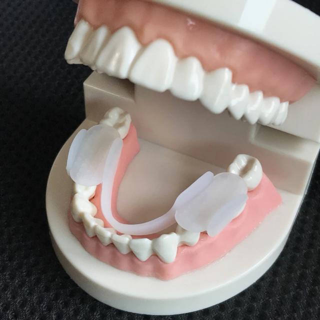 Protetor Bucal de Silicone para Moagem de Dentes - Conforto e Clareamento Noturno Universal
