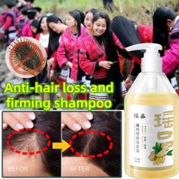 Yaopin-Shampoo Anti-Queda de Cabelo, Anti-Caspa, Anti-coceira, Suave, Controladora de Óleo, Essência Herbal Natural, 300ml - Image 1