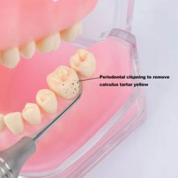 Kit de raspador de dente com design de ponta dupla 4 tamanhos, ferramenta de limpeza de dentes de exame dentário, instrumento de odontologia de aço inoxidável - Image 3