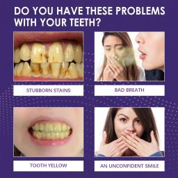 V34 clareamento dos dentes enzima pasta de dentes remover manchas de placa mousse limpeza higiene oral ferramentas dentárias respiração fresca beleza saúde - Image 4