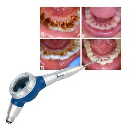 M & ycolorful plástico 2 buraco 4 buracos dental fluxo de ar dentes polimento polidor de ar handpiece higiene prophy jato ferramentas odontologia - Image 2