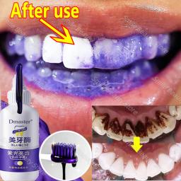 V34 clareamento dos dentes enzima pasta de dentes remover manchas de placa mousse limpeza higiene oral ferramentas dentárias respiração fresca beleza saúde - Image 1