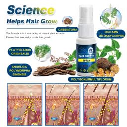 Produtos rápidos do crescimento do cabelo, cuidado capilar, reparo, perda do Anti-cabelo - Image 5