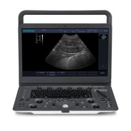 Sonoscape-ultra-som scanner e1 para o animal, equipamento veterinário para cavalo e vaca, e1v - Image 2