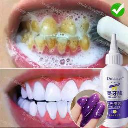 V34 clareamento dos dentes enzima pasta de dentes remover manchas de placa mousse limpeza higiene oral ferramentas dentárias respiração fresca beleza saúde - Image 3