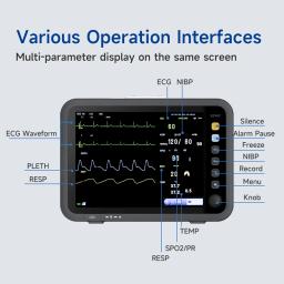 Monitor de 6 parâmetros de uso humano/vet, tela fina de 12 polegadas, ecg/nibp/pr/spo2/resp/temperatura, monitor de pacientes, monitor de sinais vitais - Image 3